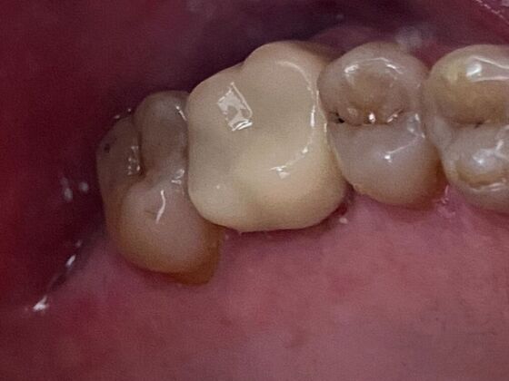 Dr. Andrews Work  Stan  - After