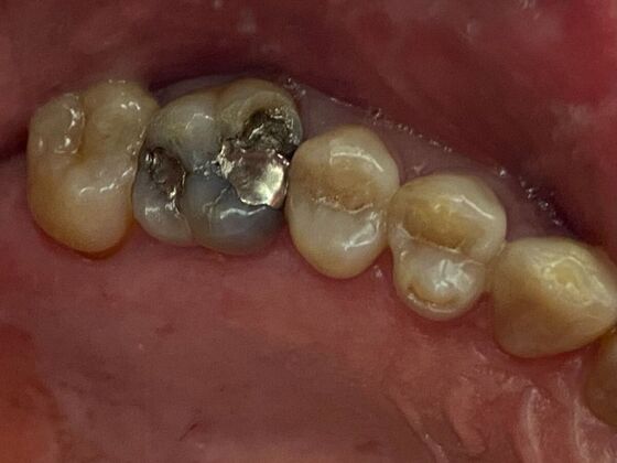 Dr. Andrews Work  Stan  - Before