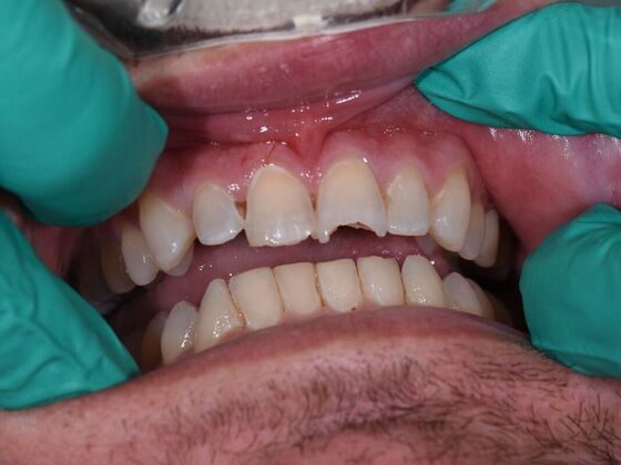 Dr. Bates Work  Brett Edwards  - Before