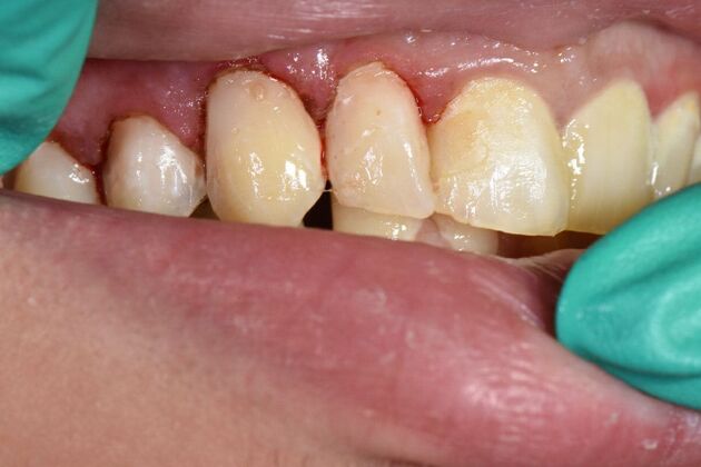 Dr. Duncans Work Cases