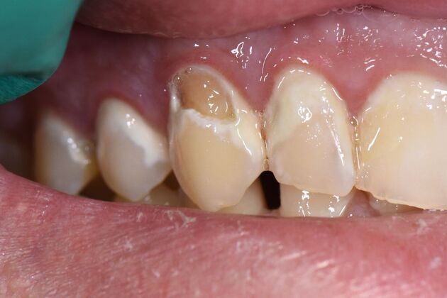 Dr. Duncans Work  Alex Pool  - Before