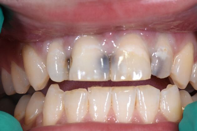 Dr. Duncans Work : Caleb Coggins - Before