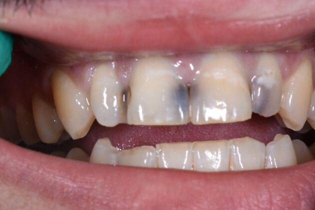 Dr. Duncans Work  Caleb Coggins  - Before
