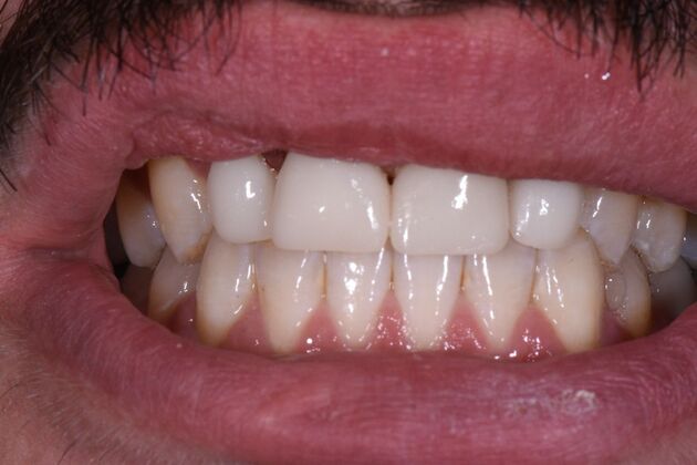 Dr. Duncans Work  Caleb Coggins  - After