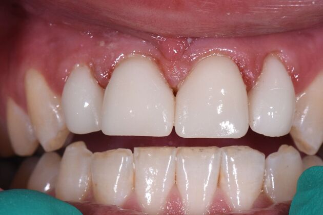 Dr. Duncans Work : Caleb Coggins - After
