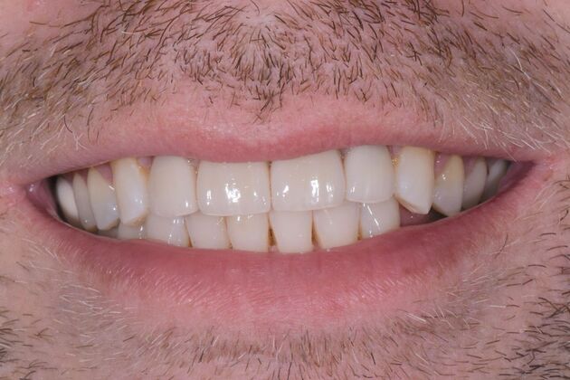 Dr. Duncans Work  Eric Williams  - After