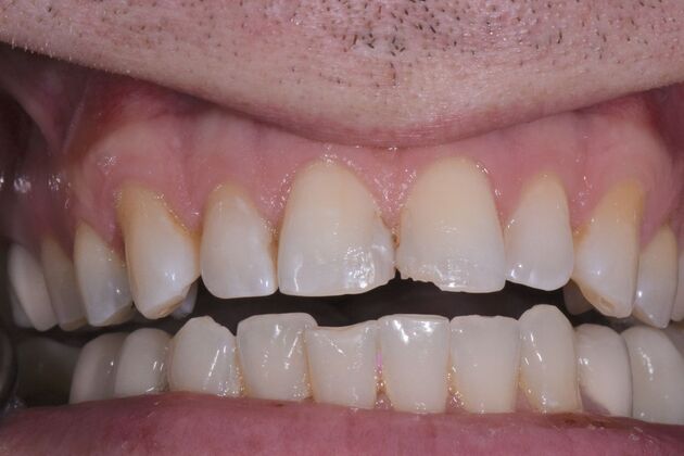 Dr. Duncans Work  Eric Williams  - Before