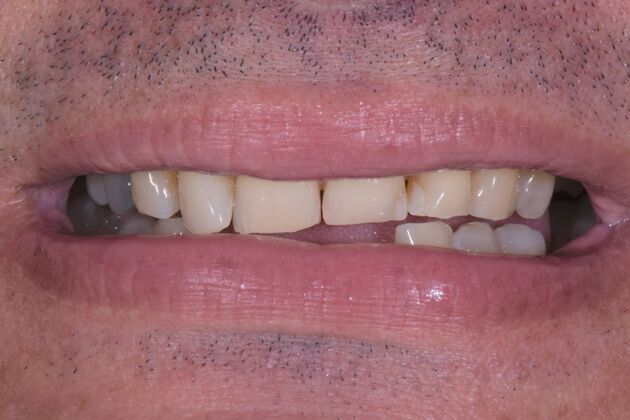 Dr. Duncans Work  Jose Venegas - Before
