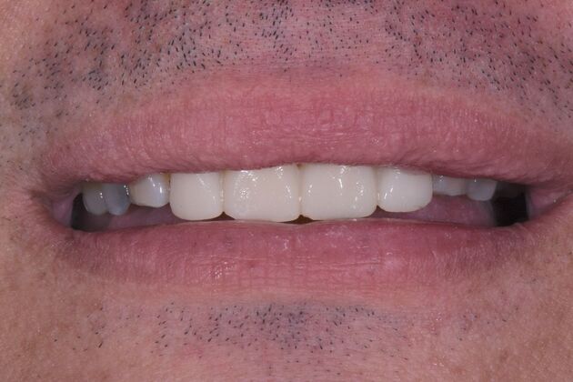 Dr. Duncans Work  Jose Venegas - After