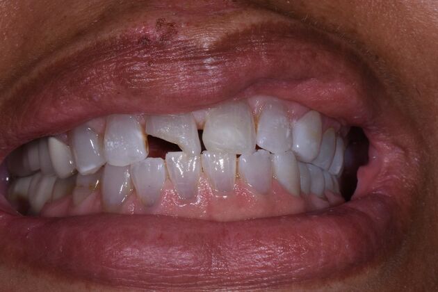 Dr. Duncans Work  LaWanda Young - Before