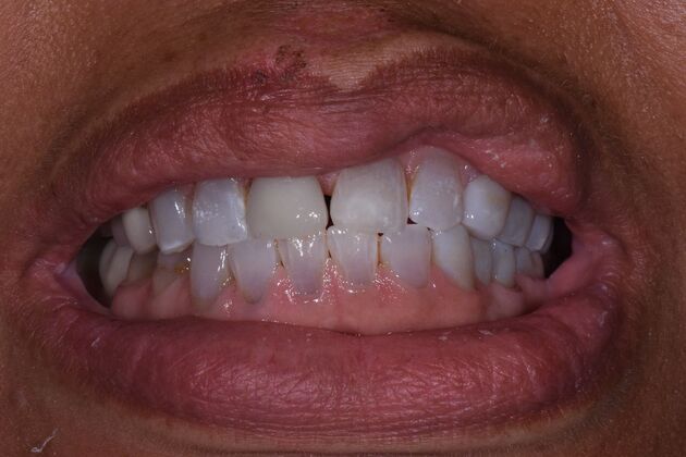 Dr. Duncans Work  LaWanda Young - After
