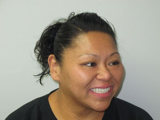 Cosmetic Crowns: Cosmetic Crowns and Individual Implants for a Brighter, Complete Smile - After
