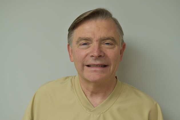 Teeth in a Day Upper Teeth in a Day and Zirconia Implant Bridge for Severe Breakdown - Before