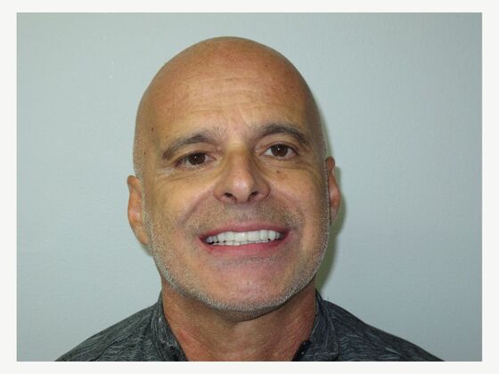 Cosmetic Crowns Upper and Lower Cosmetic Crowns for Worn, Darkened Teeth - After