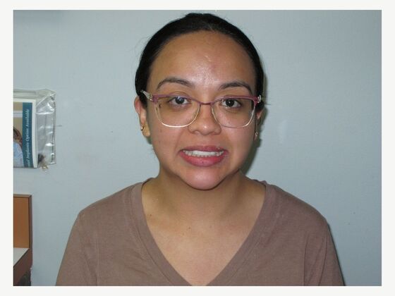 Cosmetic Crowns Cosmetic Crowns and Individual Implants for a Balanced Smile - After