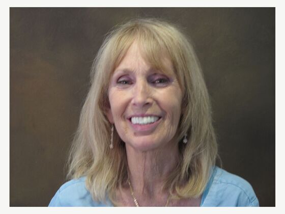 Full Mouth Implants: Full-Mouth Implant Teeth for a Brighter Fixed Smile - After