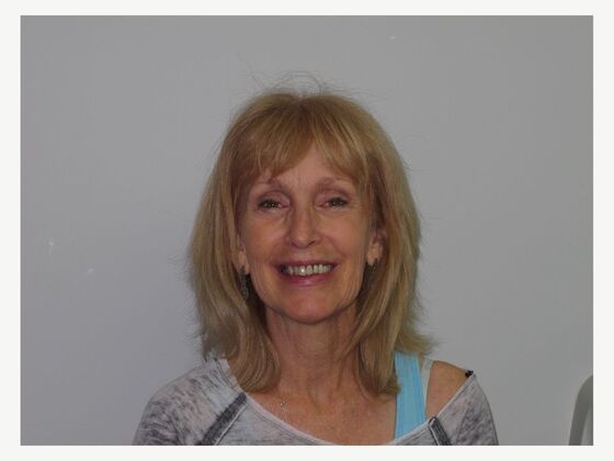 Full Mouth Implants: Full-Mouth Implant Teeth for a Brighter Fixed Smile - Before
