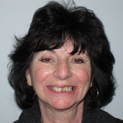 Full Mouth Implants: Denise