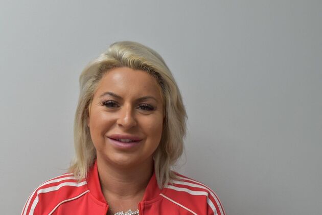 Laminates and Veneers: Christina