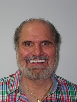 Full Mouth Implants: Joseph