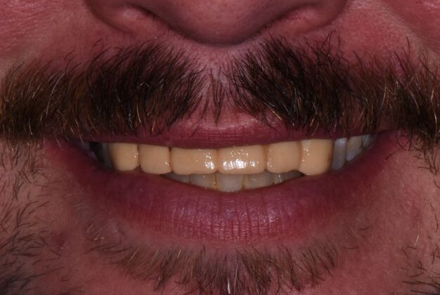 Dr. Duncans Work  Nathan Burdette  - Before