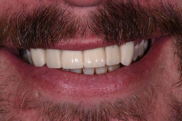 Dr. Duncans Work  Nathan Burdette  - After