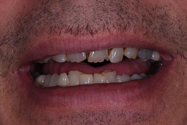 Dr. Duncans Work  Roby Bedford - Before