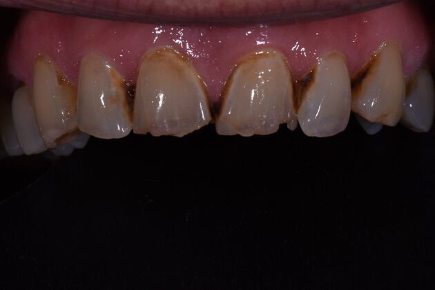 Dr. Duncans Work : Roby Bedford - Before