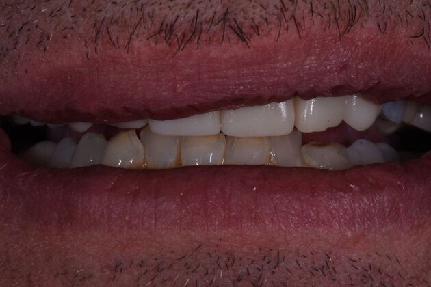 Dr. Duncans Work  Roby Bedford - After