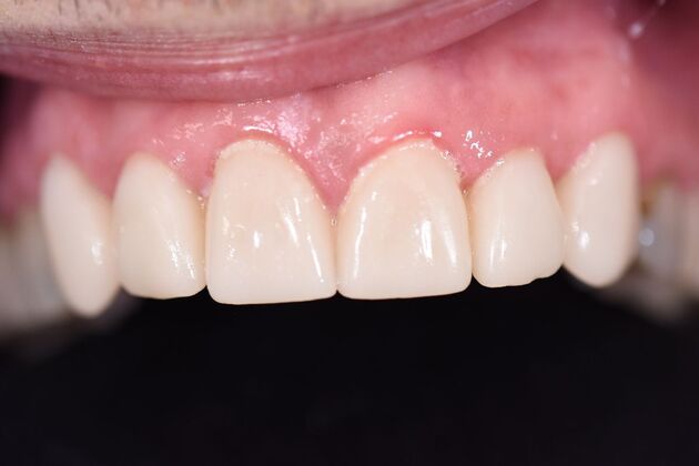 Dr. Duncans Work : Roby Bedford - After
