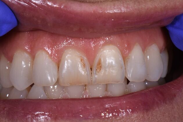 Dr. Duncans Work  Sara Kimbrell  - Before