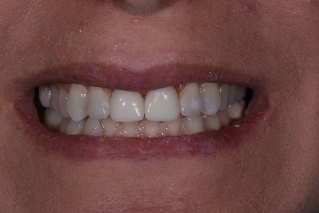 Dr. Duncans Work : Sara Kimbrell - After