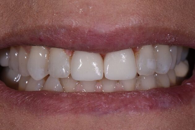 Dr. Duncans Work  Sara Kimbrell  - After
