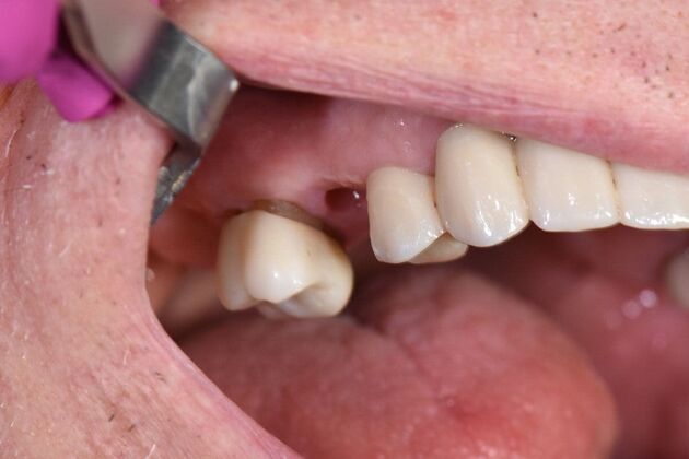 Dr. Duncans Work  Burnie Higginbothom  - Before