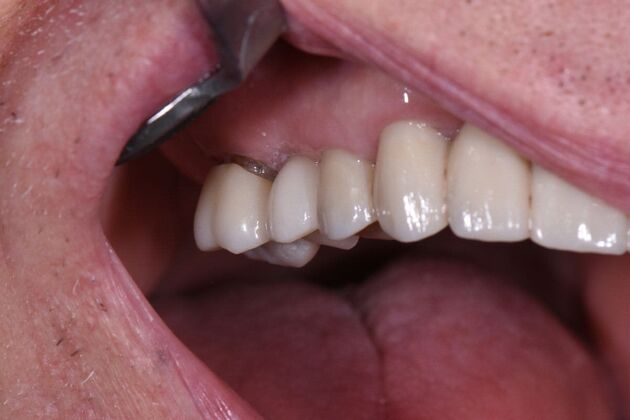 Dr. Duncans Work  Burnie Higginbothom  - After