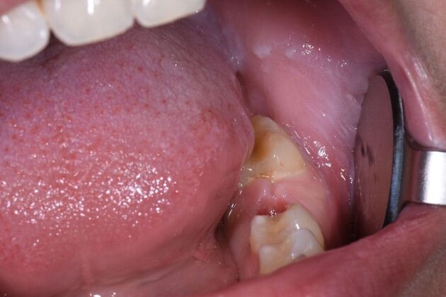 Dr. Duncans Work  Madison Barakat  - Before