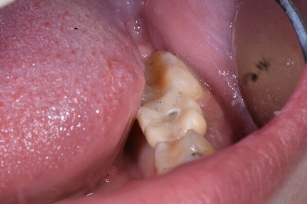 Dr. Duncans Work  Madison Barakat  - After