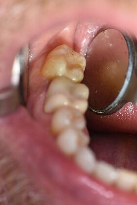Dr. Duncans Work  Bill Windle  - After