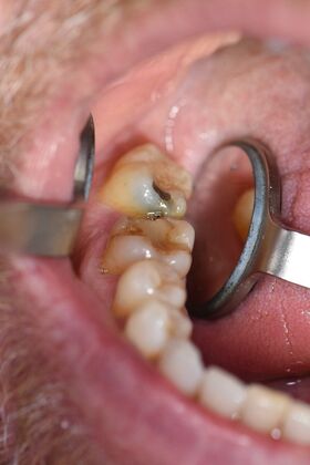 Dr. Duncans Work  Bill Windle  - Before