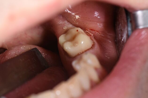 Dr. Duncans Work  Daniel Allen  - After