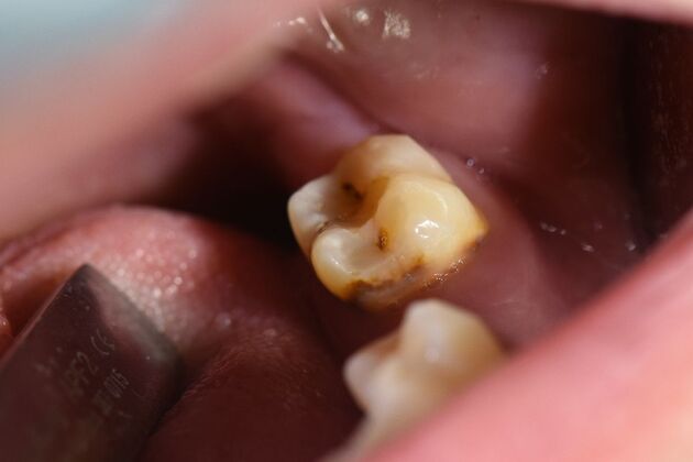 Dr. Duncans Work  Daniel Allen  - Before