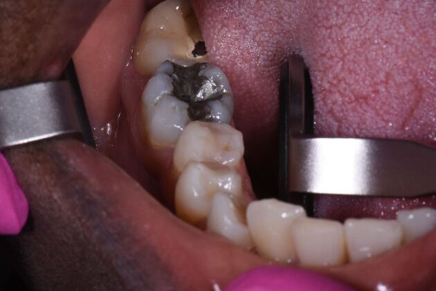 Dr. Duncans Work  Diana Lyons - Before