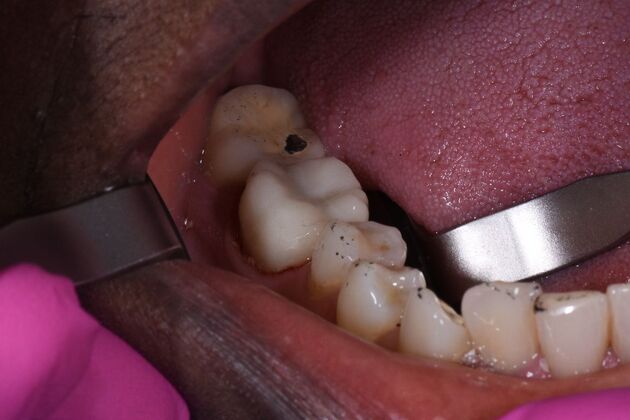Dr. Duncans Work  Frances Gibson  - After