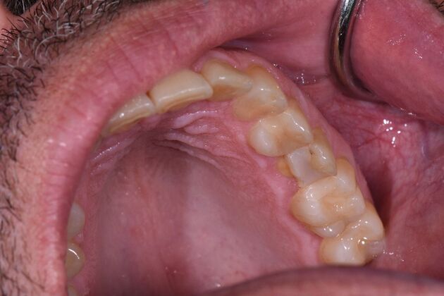 Dr. Duncans Work  Frank Garibay - Before
