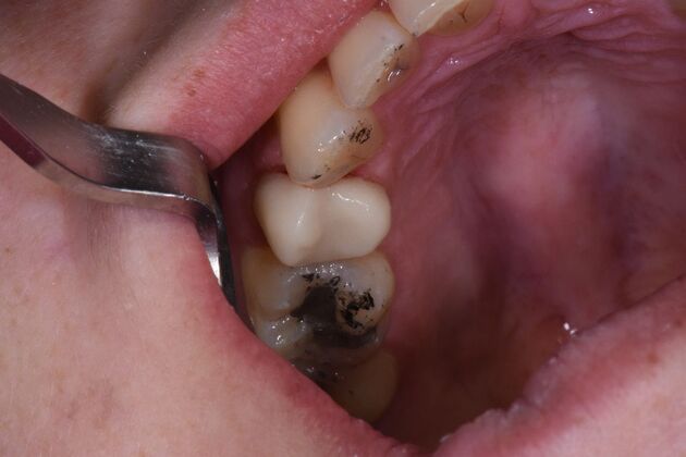 Dr. Duncans Work  Jennifer Mayhew  - After