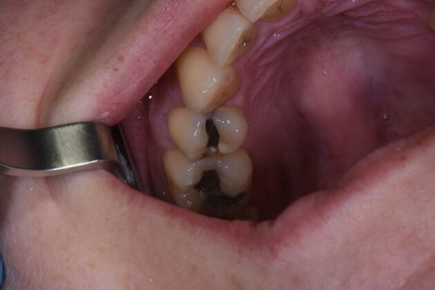 Dr. Duncans Work  Jennifer Mayhew  - Before