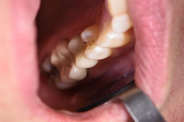 Dr. Duncans Work  Jennifer Solomon  - After