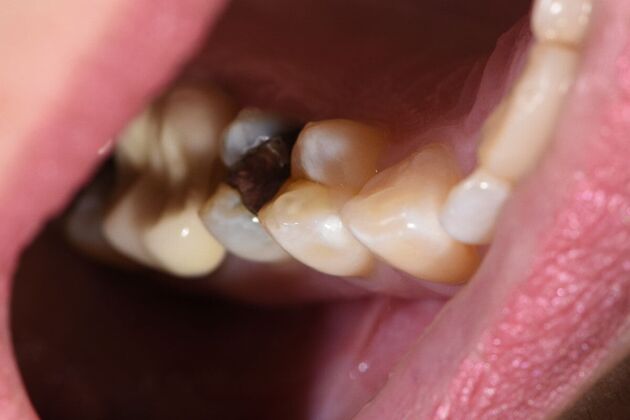 Dr. Duncans Work  Jennifer Solomon  - Before