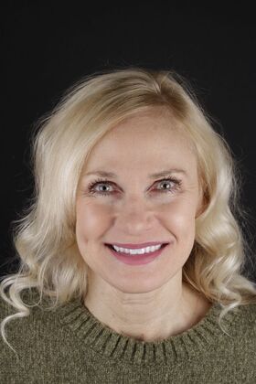 Our Smile Transformations Stephanie - Before