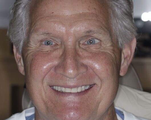 Our Smile Transformations Kevin - Before